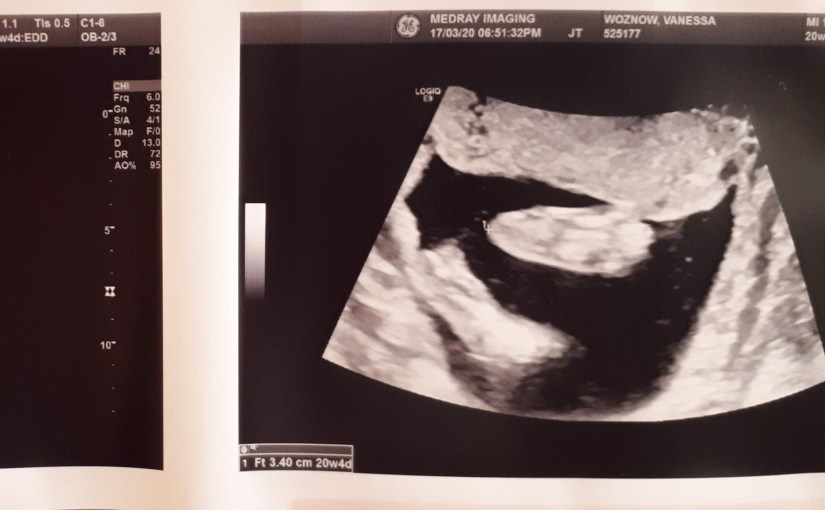 Dear Momma, I’m pregnant and it’s a&nbsp;pandemic